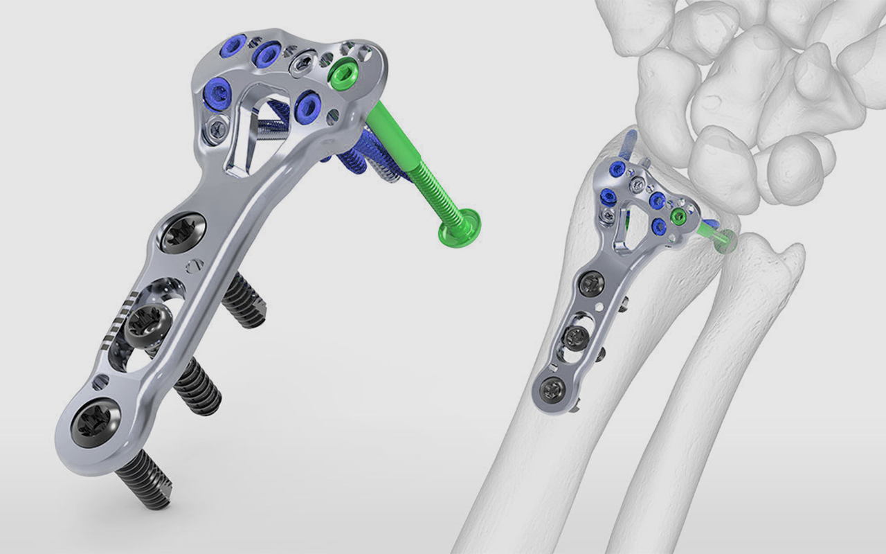 Medical Device Components & Precision Machined Parts